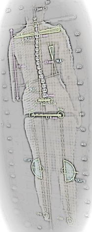 Analyse posturale SPINE 3D